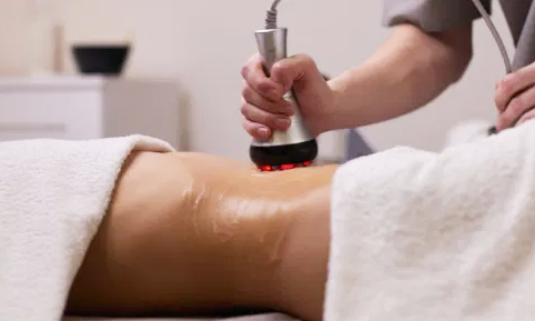 Cavitation κατά της κυτταρίτιδας - Τοπικό Αδυνάτισμα