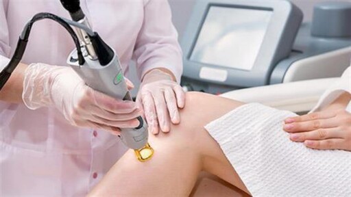 Αποτρίχωση με Laser Αλεξανδρίτη